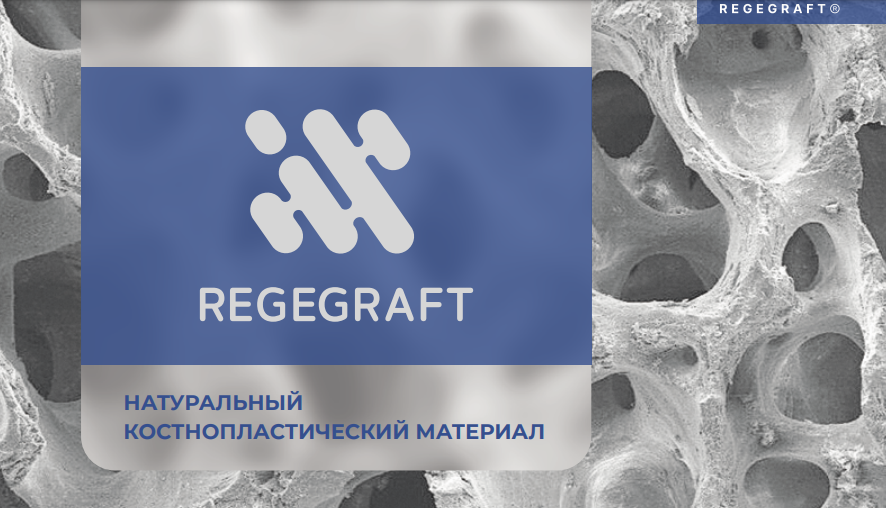 Натуральный костнопластический материал REGEGRAFT
