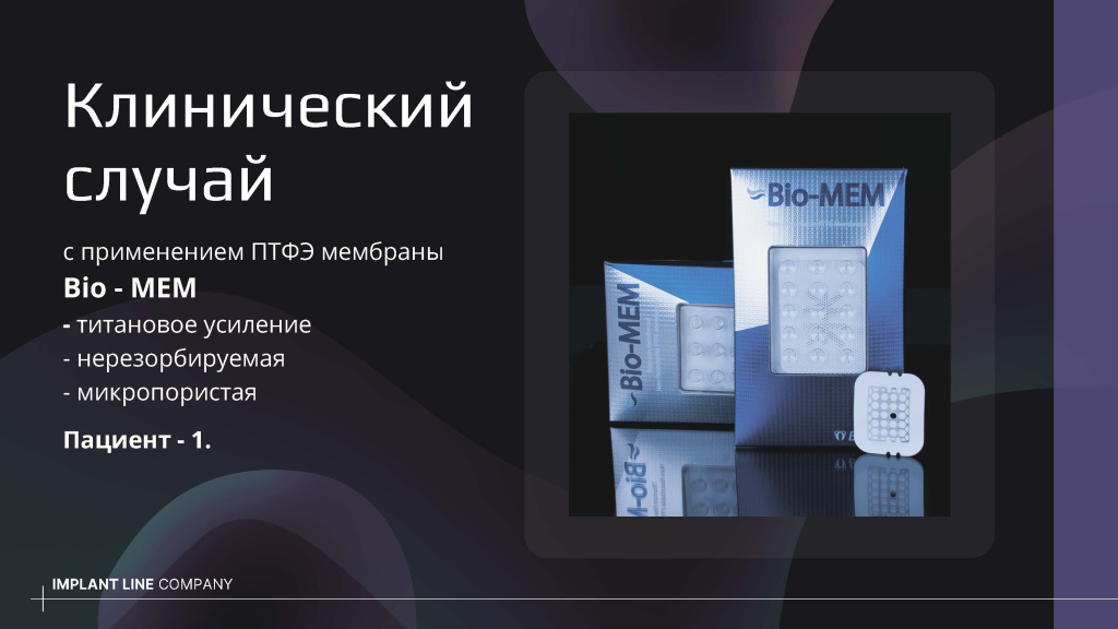Klinicheskiy-sluchay-ispolzovaniya-PTFE-membrany-Bio_MEM_1 1.jpg