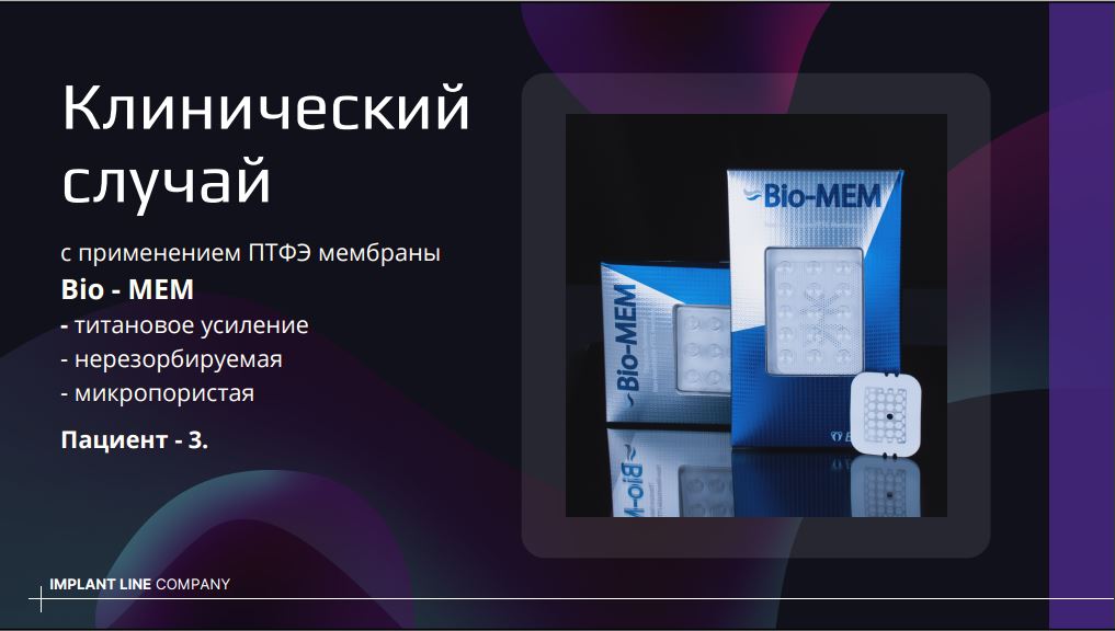 клинический случай 3.JPG